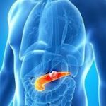 Панкреатит: причини та симптоми